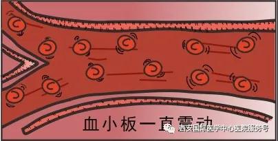 【科普】血小板是正常值的三倍？專家提醒小心血栓和出血！