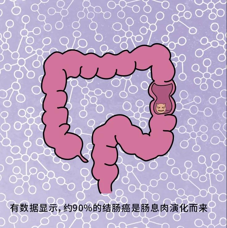 奪走“黑豹”生命的結(jié)腸癌，到底什么來頭？