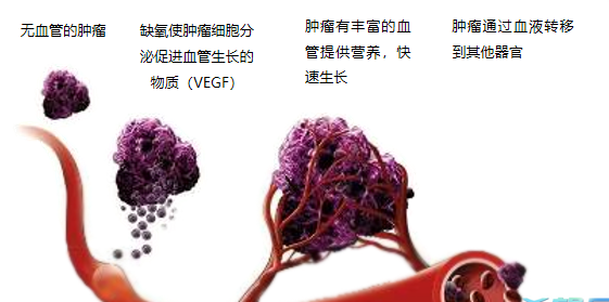 晚期腫瘤為什么會復(fù)發(fā)轉(zhuǎn)移？