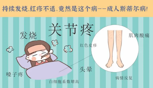 持續(xù)發(fā)燒、紅疹不退……她終于在這里治好了這個(gè)罕見病