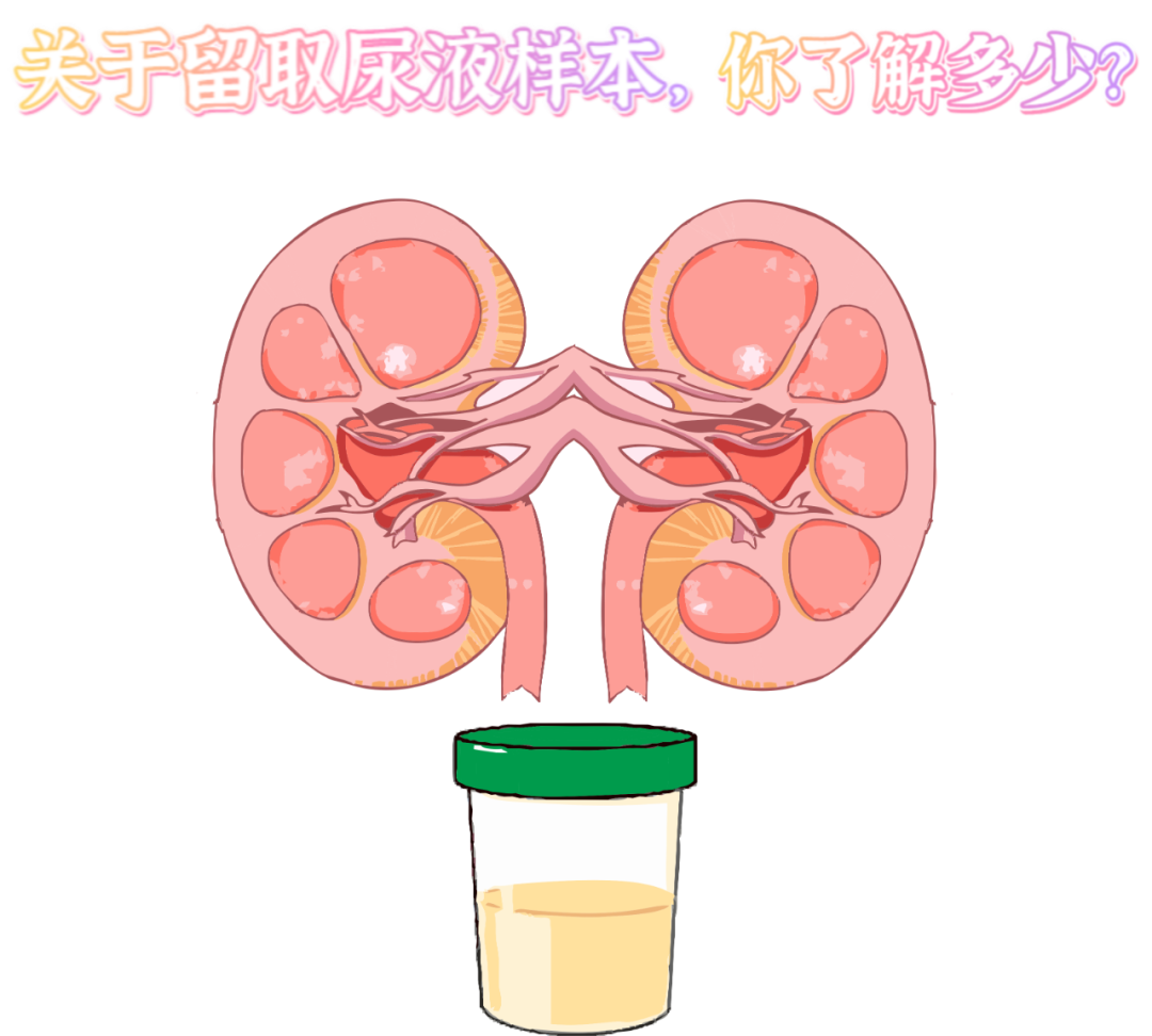 做尿檢，不得不說的注意事項(xiàng)！