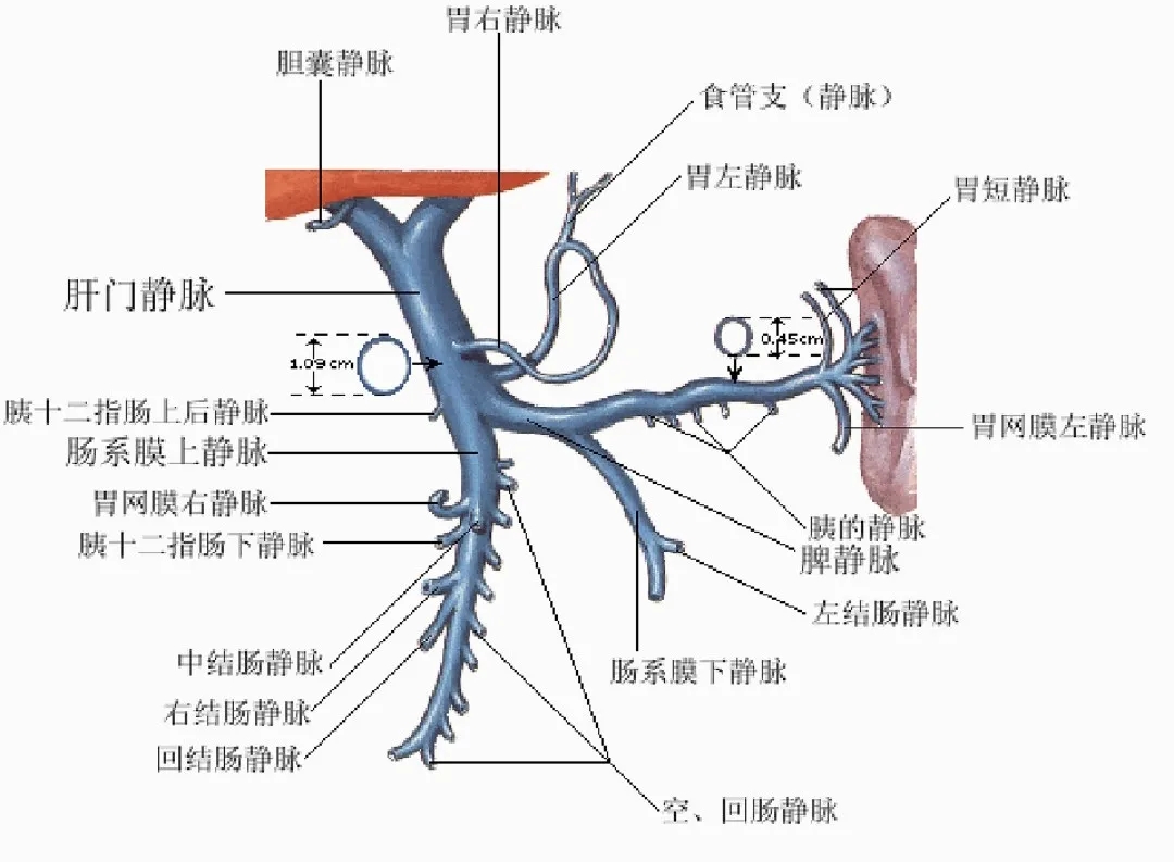 反復(fù)嘔血、黑便怎么辦？TIPS手術(shù)能解決