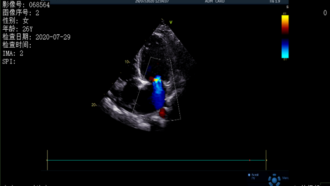 心電圖異常，心臟卻沒(méi)事，罪魁禍?zhǔn)资恰?>
				             </a>
                <div   id=