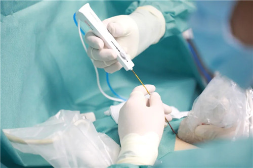 針尖上的絕絕子①｜從重慶到西安，23歲的姑娘只為了這件事……周曉東和他的超聲團隊