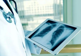 健康呼吸④體檢發(fā)現(xiàn)肺結(jié)節(jié)，我該怎么辦？