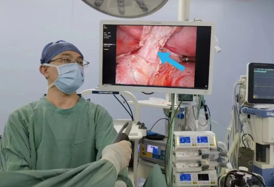 30歲小伙持續(xù)發(fā)燒咳嗽，原來是多長一塊肺......