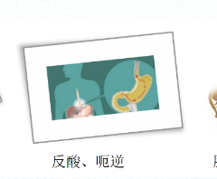 關(guān)愛身體健康，輕松檢查胃腸