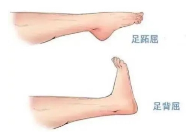 扭胯小連步、動(dòng)感搖花手……“科目三”雖火，運(yùn)動(dòng)損傷也要防！