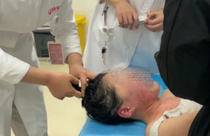 14歲，面、頸、胸燙傷，只因中午那鍋面湯…